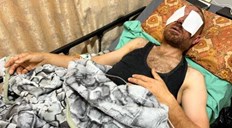 الفدائي "المبحوح".. يواجه خطر فقدان بصره بانفجار جسم من مخلفات الاحتلال