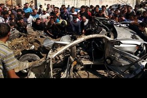 Gaza under fire: four-year-old- child injured by Israeli warplanes