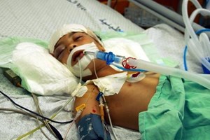 محدث: 166 شهيداً وأكثر من 1120 جريحاً منذ بدء العدوان