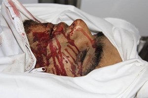 ليلة ساخنة على محافظتي رفح وخانيونس تخلِّف عشرة شهداء