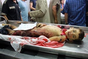 صور مؤلمة: اليوم العاشر للعدوان.. أجساد رقيقة مزقتها القذائف الغادرة