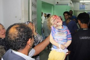 52 شهيداً و 2200 جريحاً حصيلة اليوم الثاني عشر للعدوان