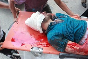 Israel uses Uranium to bomb civilians in Gaza