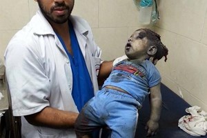  شهيدتان  وعدد من الجرحى في استهداف منزل لعائلة الدلو بغزة