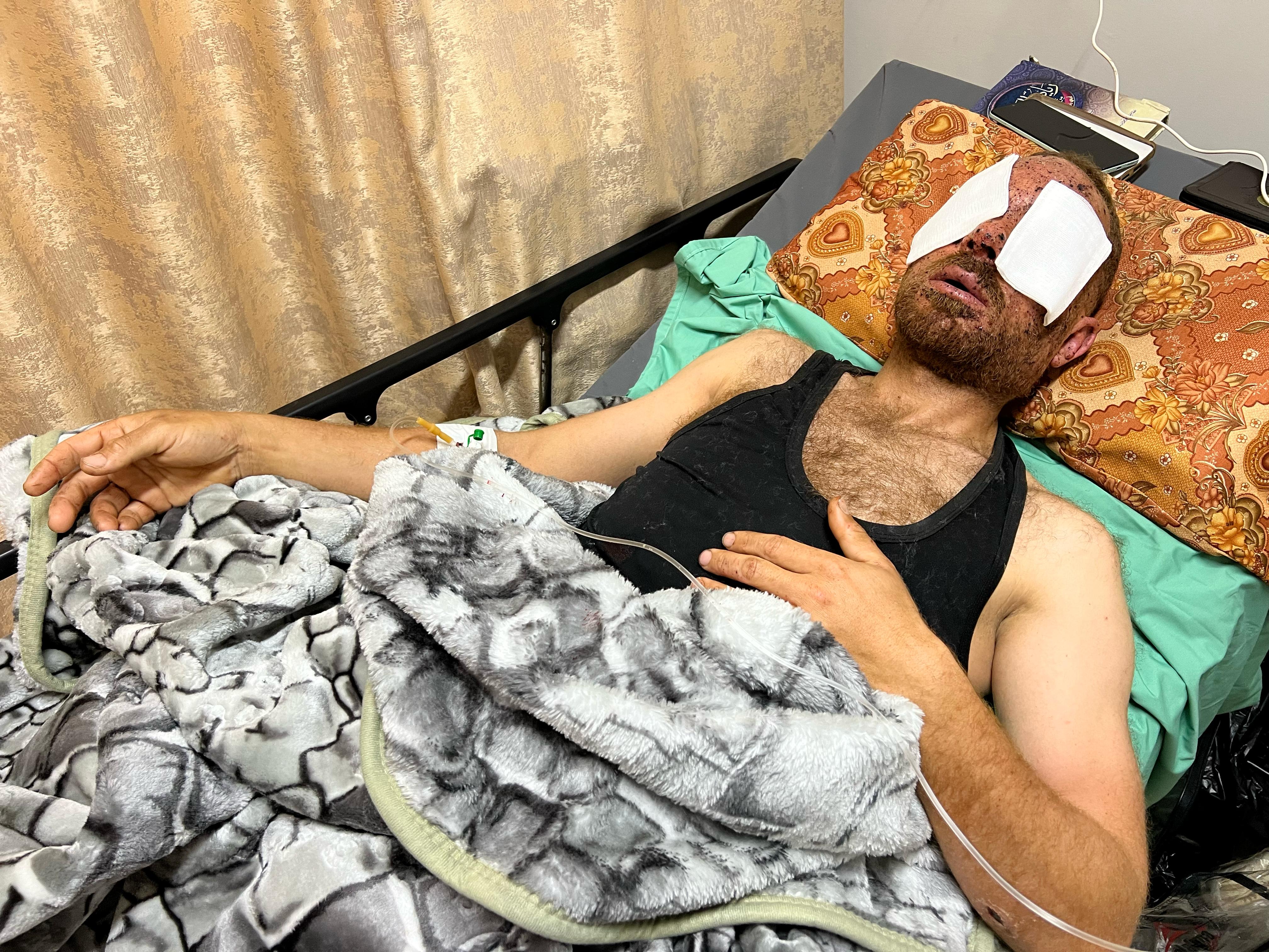 الفدائي "المبحوح".. يواجه خطر فقدان بصره بانفجار جسم من مخلفات الاحتلال